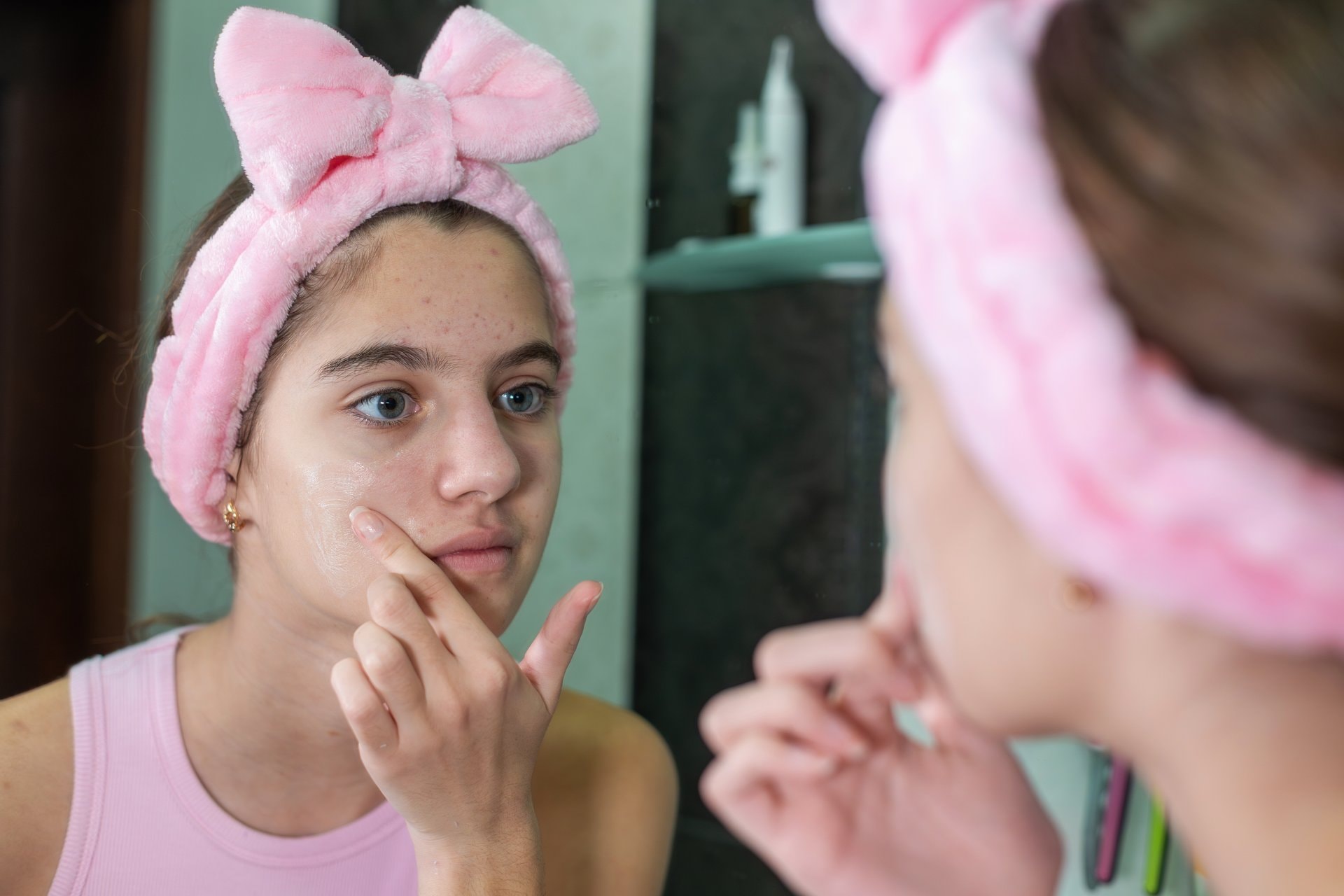Akne kod tinejđera: kada je vrijeme za dermatologa?