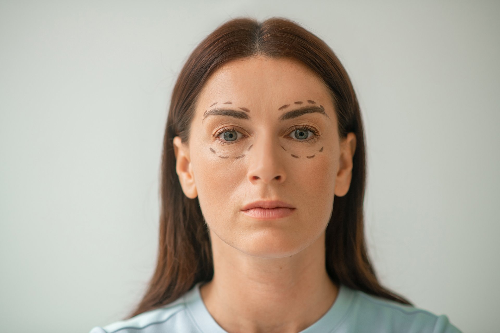 Blepharoplastika: operacija kapaka koja osvježava pogled