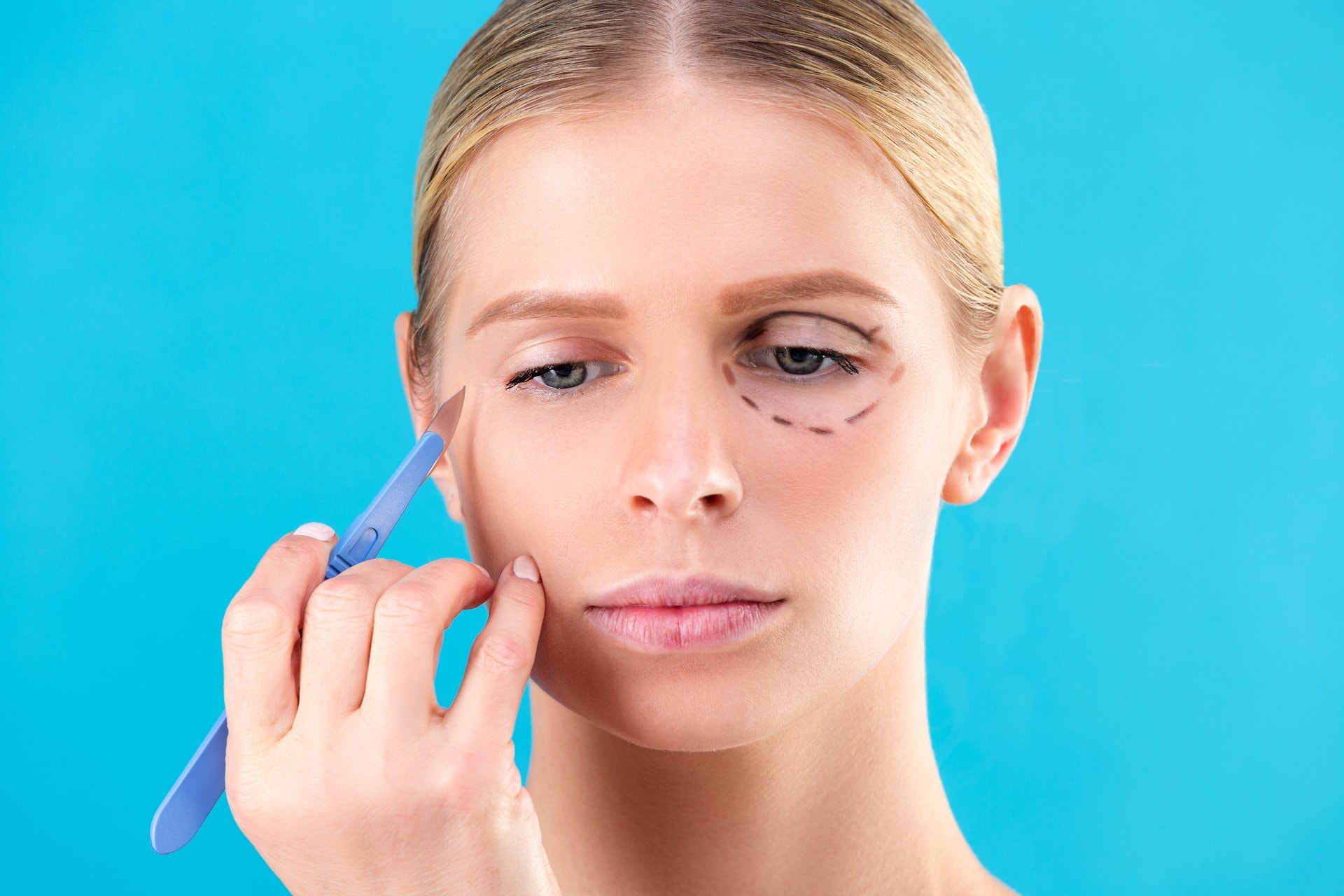 Blepharoplastika: operacija kapaka koja osvježava pogled