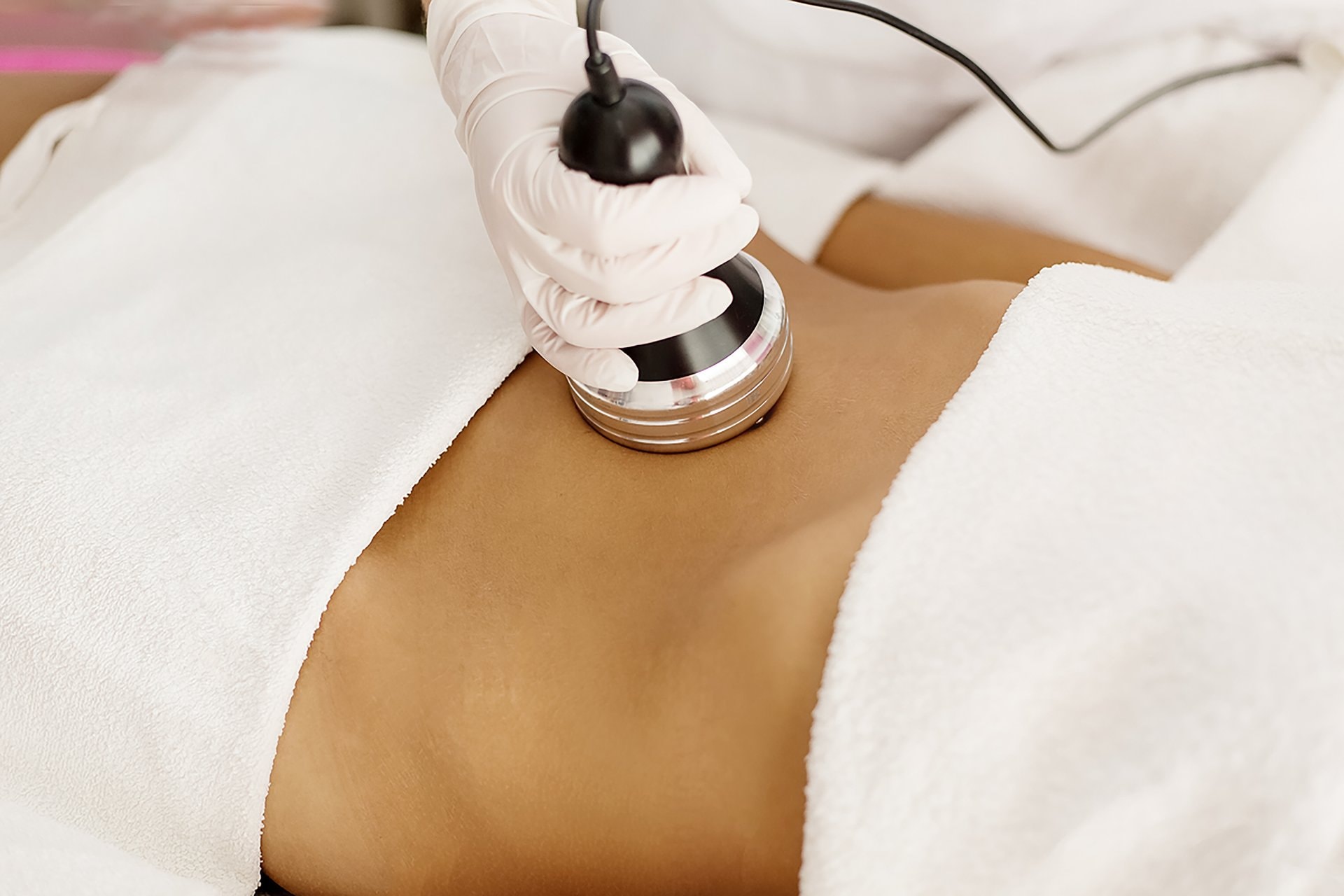 Coolsculpting: zamrzavanje masnih naslaga bez operacije