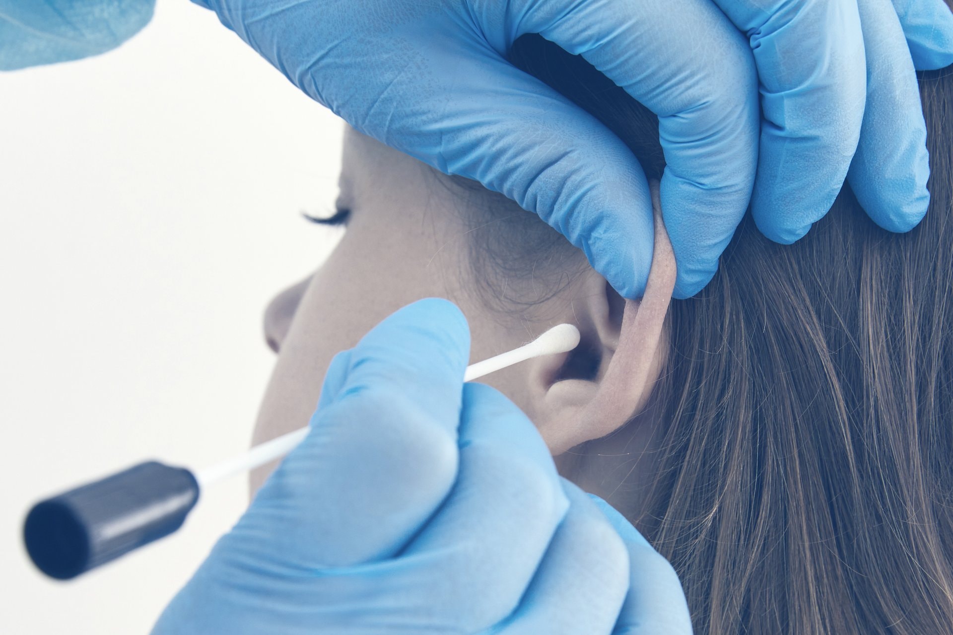 Otoplastika: korekcija klempavih ušiju bez vidljivih tragova