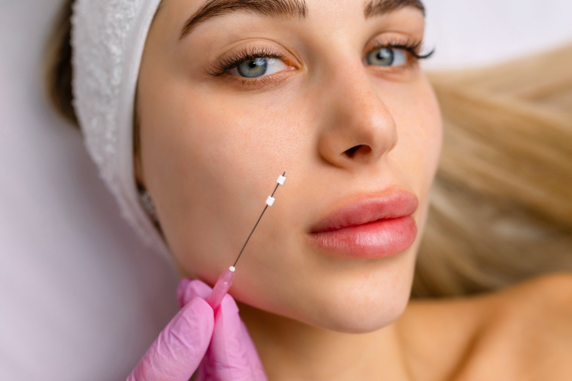 PDO niti za tijelo: zatezanje kože na vratu, rukama i trbuhu