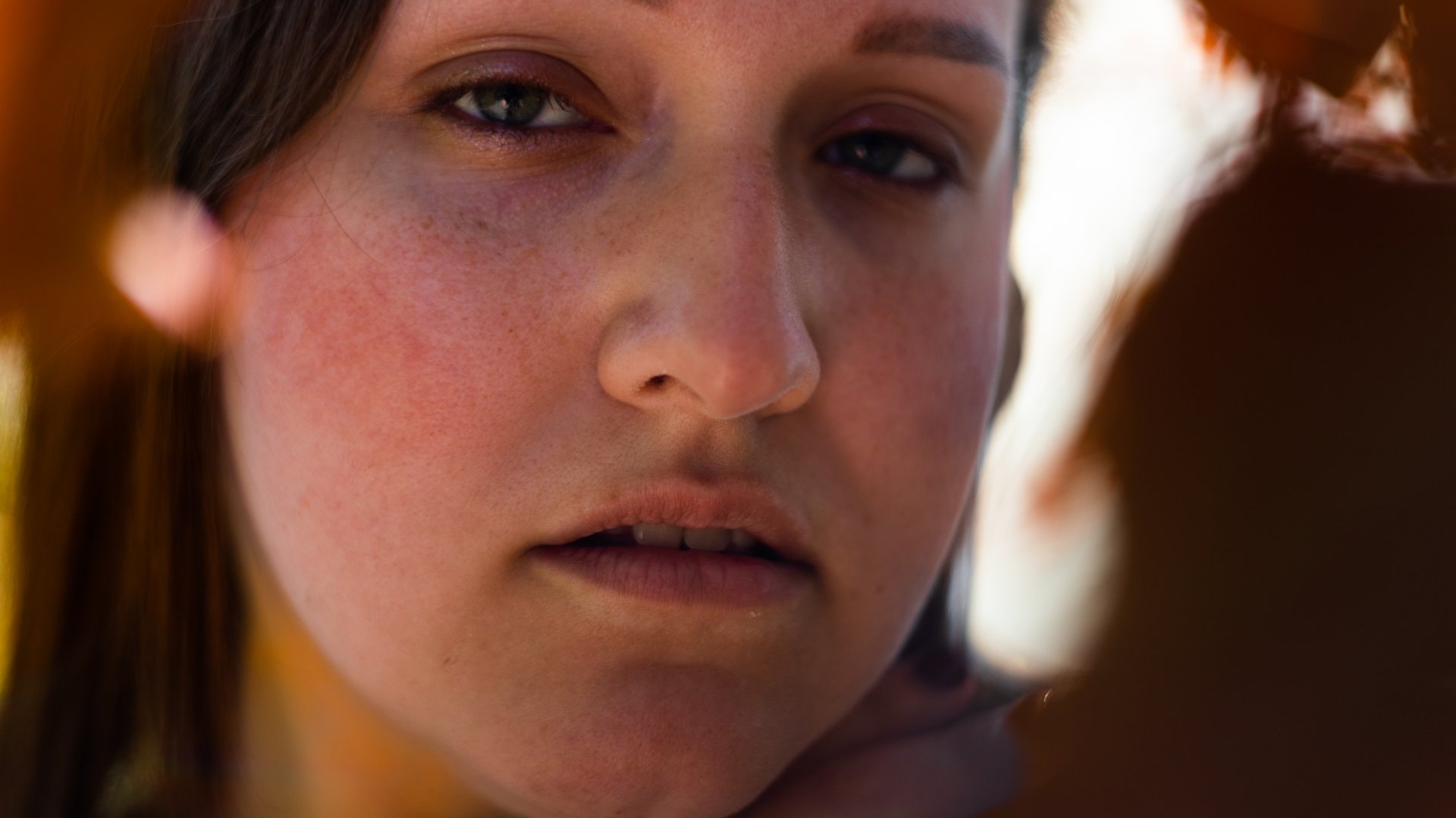 Rosacea: kako prepoznati i kontrolisati crvenilo kože