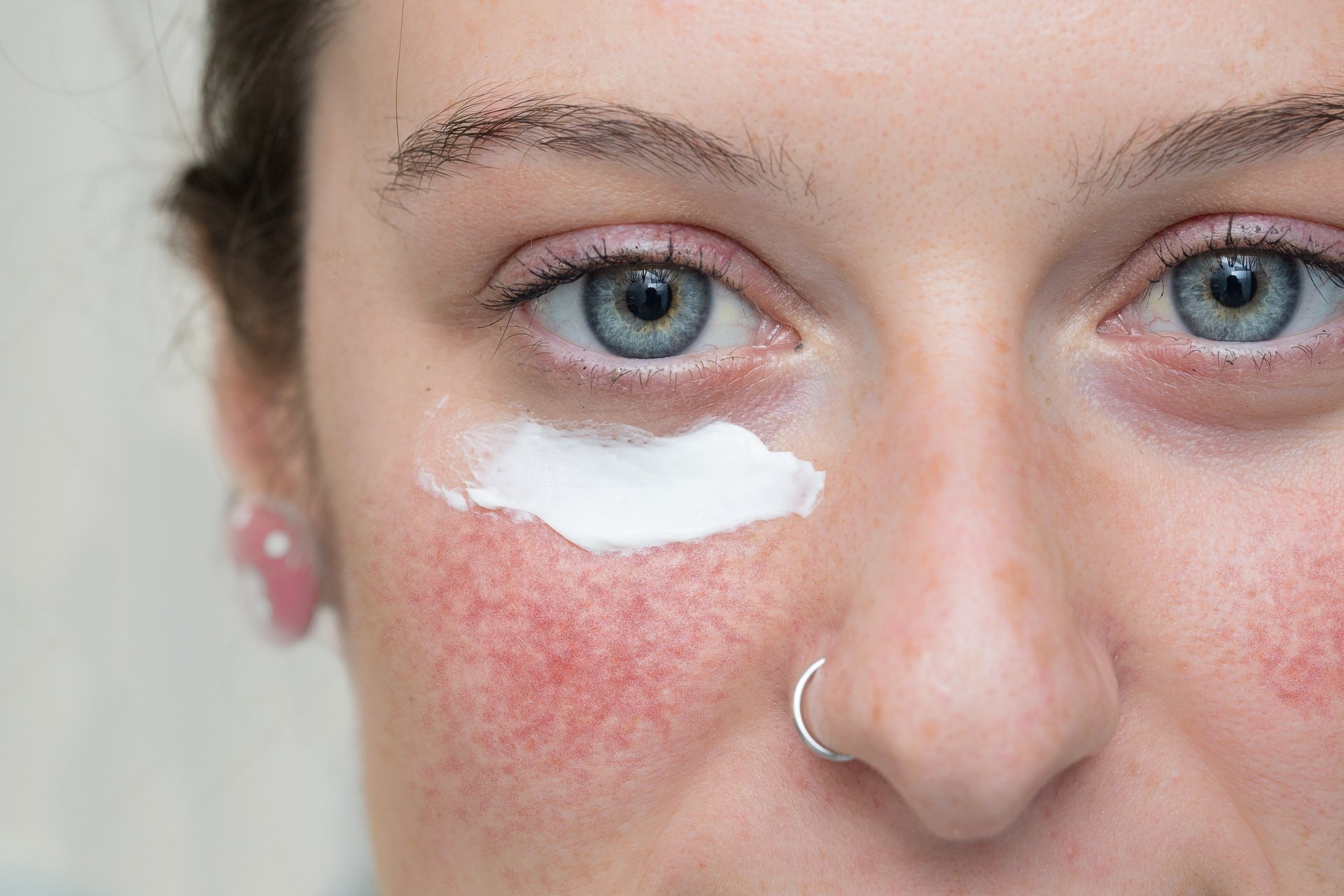 Skincare rutina za osjetljivu kožu: šta koristiti?