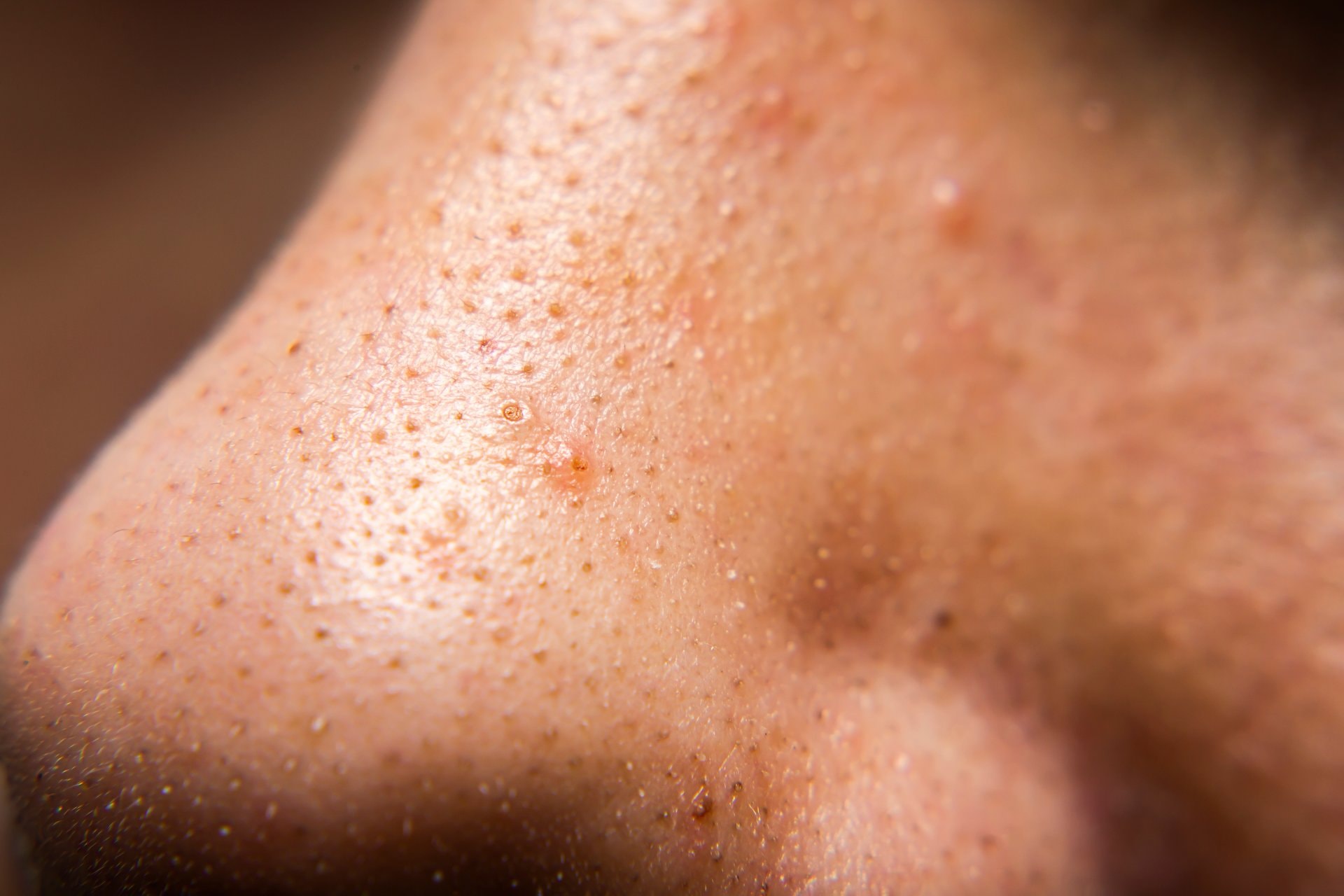 Pore pod lupom: Iskren test 6 proizvoda za čišćenje