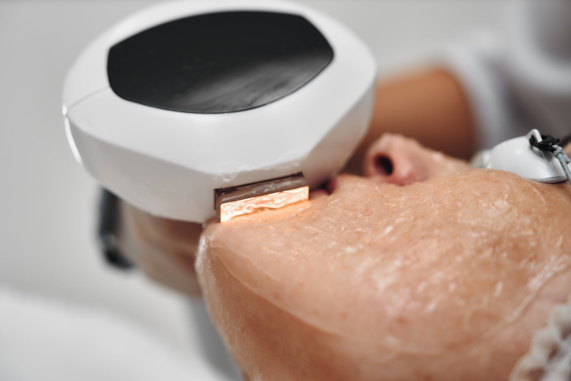 Ultherapy: ultrazvučni lifting bez operacije