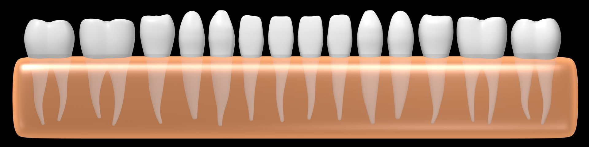 Veneers ili kompozitne ljuskice: uporedni vodič