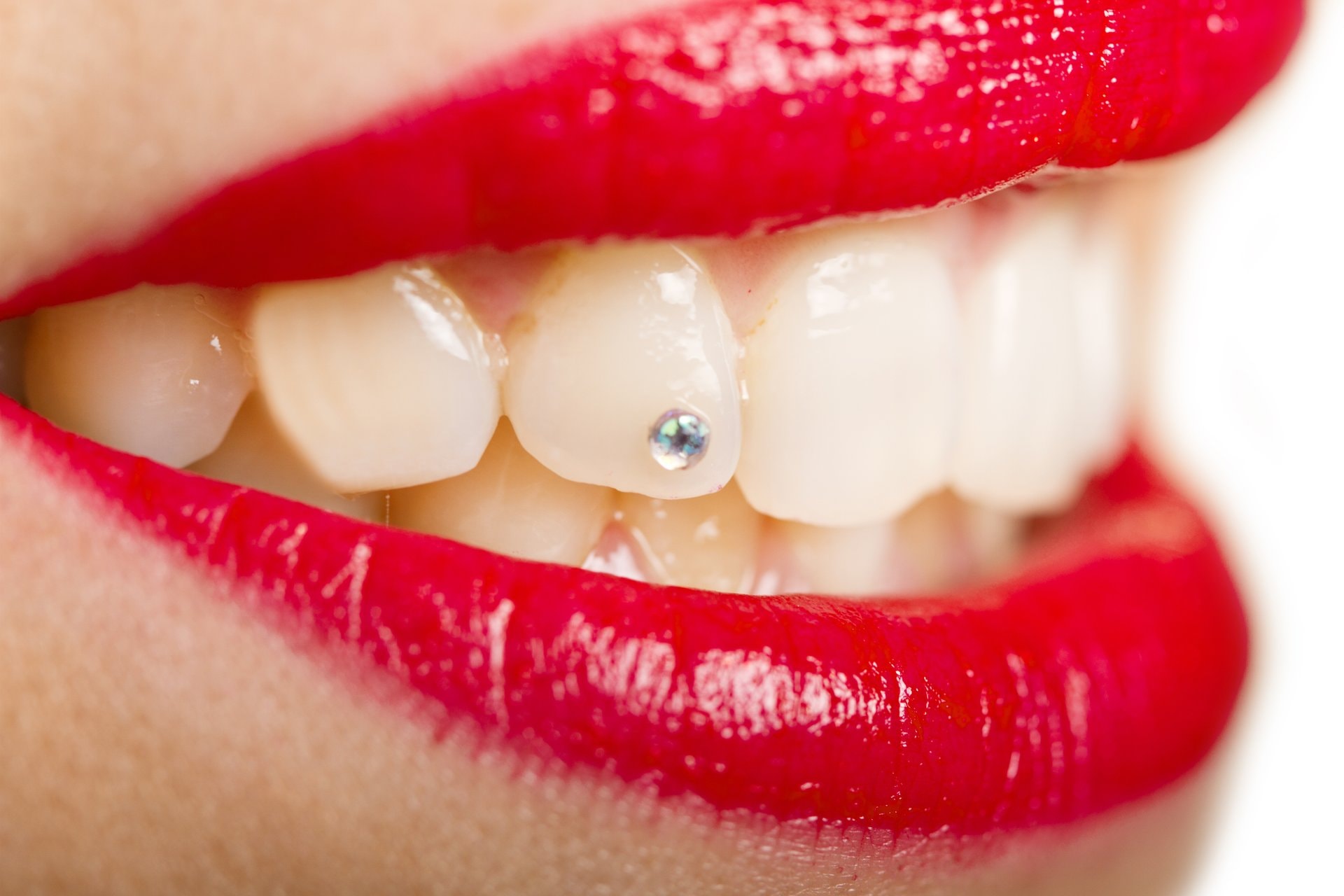 Zubni nakit i tooth gems: trend, ugradnja i rizici za zube